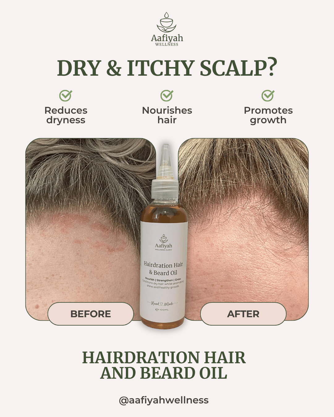 Hairdration Organic Hair & Beard Growth Oil - 100ml - Aafiyah Wellness Clinic