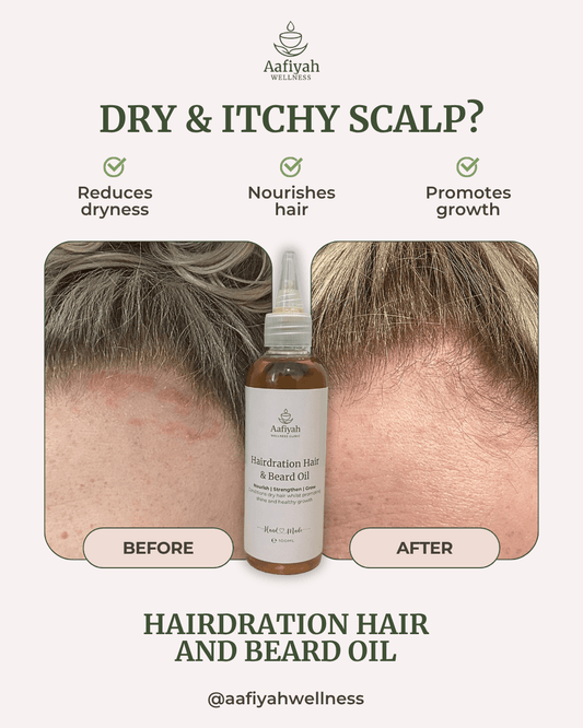 Hairdration Organic Hair & Beard Growth Oil - 100ml - Aafiyah Wellness Clinic