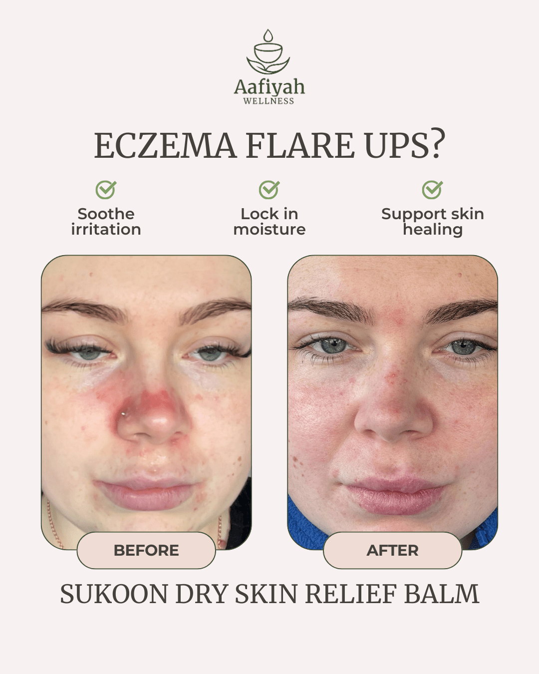 Sukoon Dry Skin Relief Balm - Aafiyah Wellness Clinic
