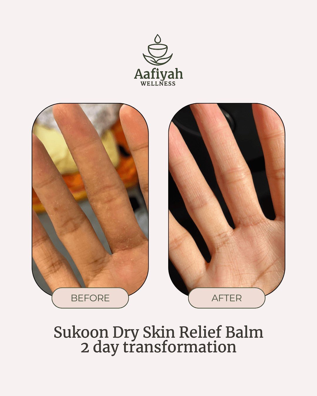 Sukoon Dry Skin Relief Balm - Aafiyah Wellness Clinic