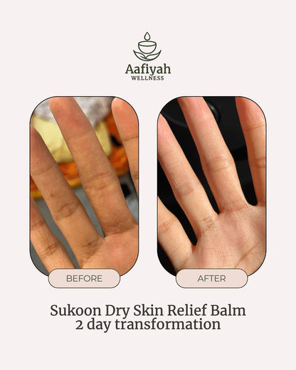 Sukoon Dry Skin Relief Balm - Aafiyah Wellness Clinic