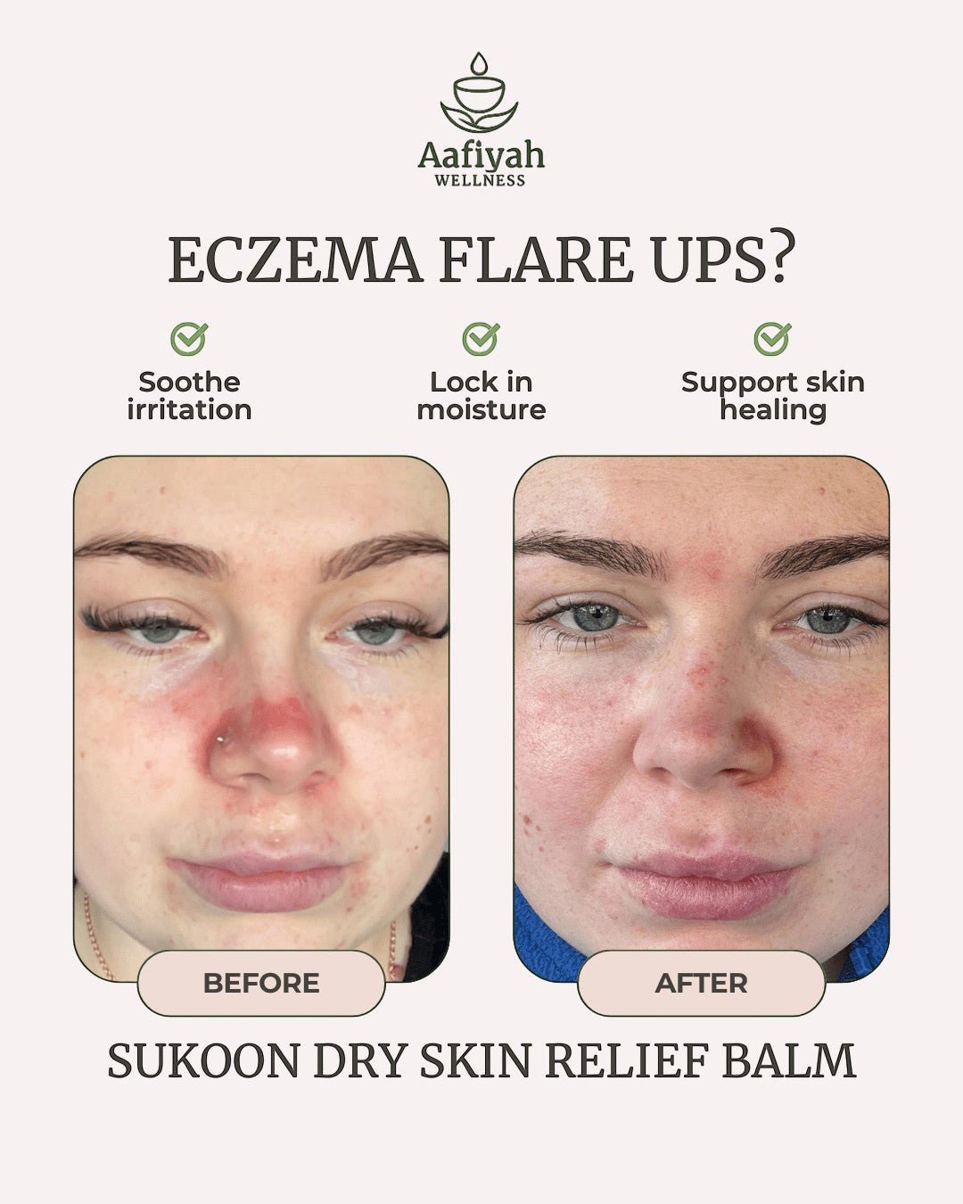 Sukoon Dry Skin Relief Balm - Aafiyah Wellness Clinic