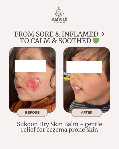 Sukoon Dry Skin Relief Balm - Aafiyah Wellness Clinic